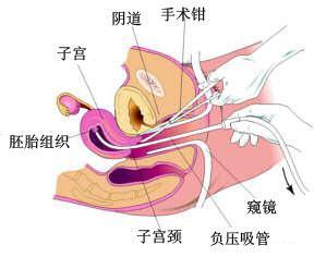 人流的注意细节